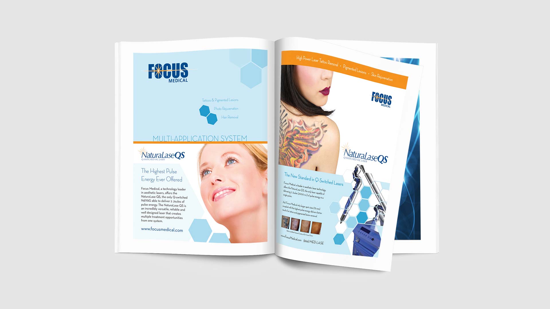 Cosmetic laser advertising in Chicago IL